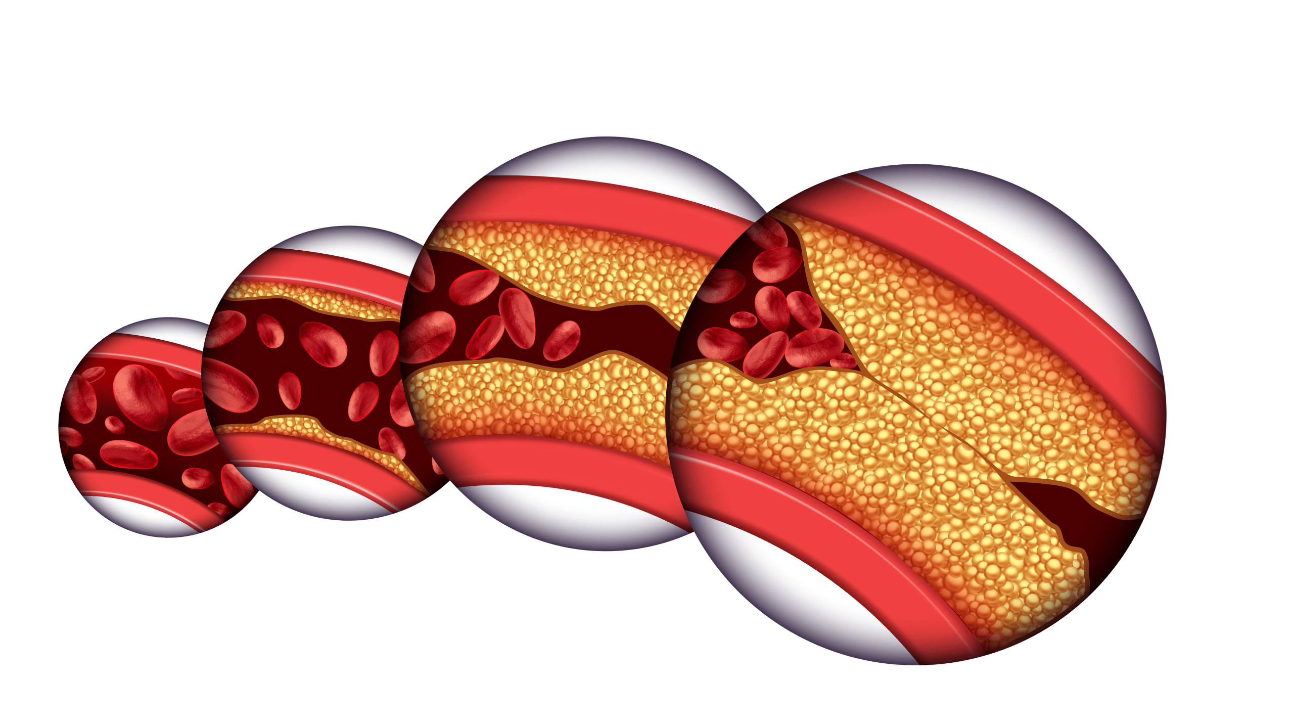 colesterol