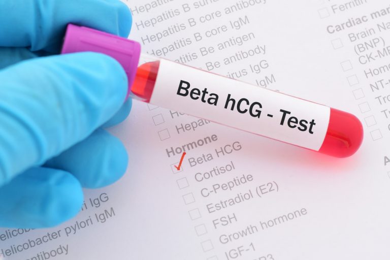 Entendendo o Beta HCG: O Que É, Para Que Serve e Quando Fazer o Exame